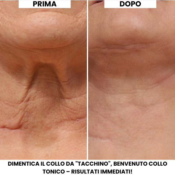 Crema Lifting Collo Evonex®