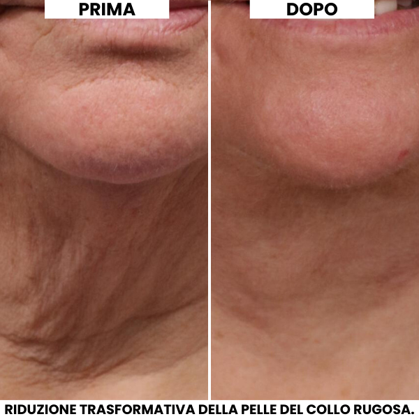 Crema Lifting Collo Evonex®