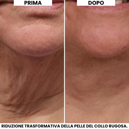 Crema Lifting Collo Evonex®